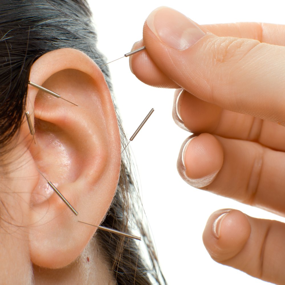 5 Point Auricular Acupuncture Course